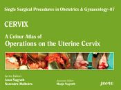 Single Surgical Procedures in Obstetrics and Gynaecology-07: Cervix-A Colour Atlas of Operations on the Uterine Cervix / Nagrath, Arun & Malhotra, Narendra 