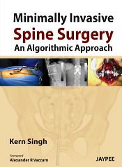 Minimally Invasive Spine Surgery: An Algorithmic Approach / Singh, Kern 