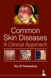 Common Skin Diseases: A Clinical Approach / Chattopadhyay, S.P. (Brig.)