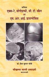 X-Ray, Sonography, CT Scan evam MRI Diagnosis (Sachitra) / Choube, Priya Kumar 