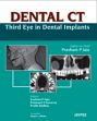 Dental CT: Third Eye in Dental Implants /  Jaju, Prashant P.; Jaju, Sushma P; Suvarna, Prashant V. & Dedhia, Pratik 